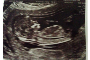 8/7/2015: Rysiu & Stephanie are going to have a Daughter!!!